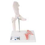 3B Scientific Mini Human Hip Joint Model with Cross Section - 3B Smart Anatomy