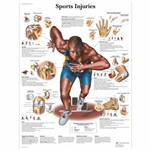3B Scientific Sports Injuries Chart (Laminated)