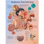 3B Scientific Respiratory Tract Infections Chart (Non Laminated)