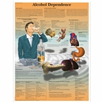 3B Scientific Alcohol Dependence Chart (Non Lamination)