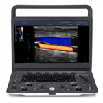 SonoScape E2 Color Portable Digital Ultrasound System