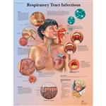 3B Scientific Respiratory Tract Infections Chart