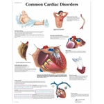 3B Scientific Common Cardiac Disorders Chart