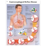 3B Scientific Gastroesophageal Reflux Disease Chart